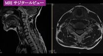 1.手技手技と症例解説