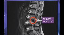 2.症例解説