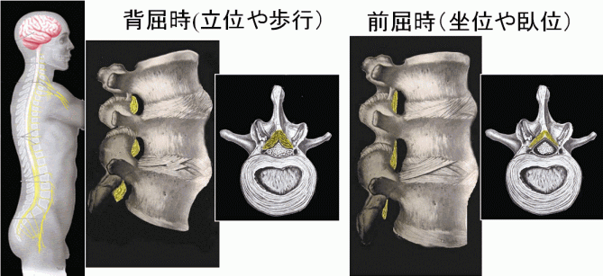 背屈時、前屈時に脊柱管が広くなったり狭くなったりする仕組み