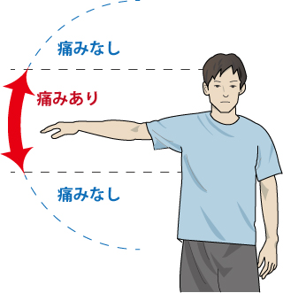 肩 腱 板 断裂 症状