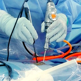 UBE手術イメージ