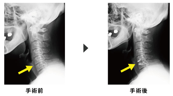 ケージ挿入後の写真