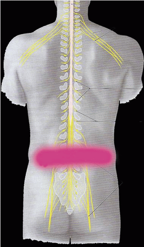 腰椎椎間板変性症で痛みやしびれが発生する部位