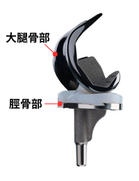 人工膝関節置換術｜岩井整形外科病院